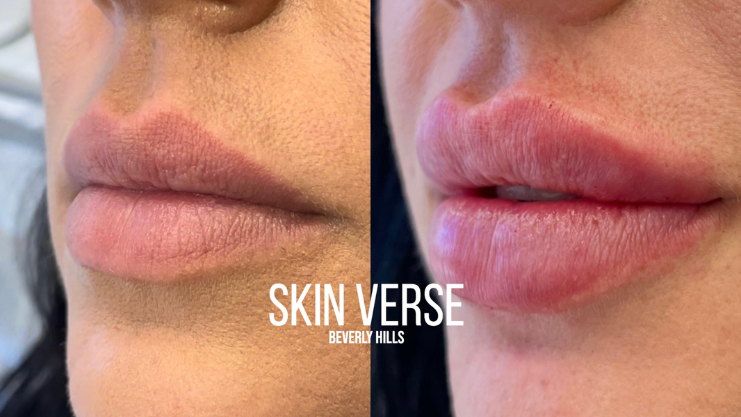 Cover photo of Skin Verse Medical Spa Botox Beverly Hills - Laser Hair Removal Medspa And Injectables